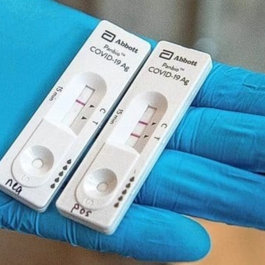 Los primeros autotest estarían disponibles la próxima semana en farmacias, a 1.560 pesos