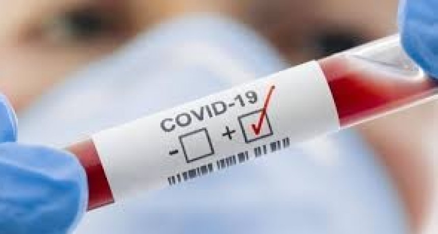  13.667 personas fueron diagnosticadas con coronavirus en el país