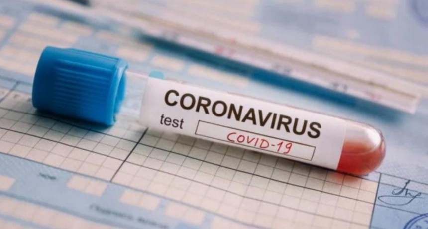 Argentina tiene 22.020 infectados y 648 fallecidos por COVID-19