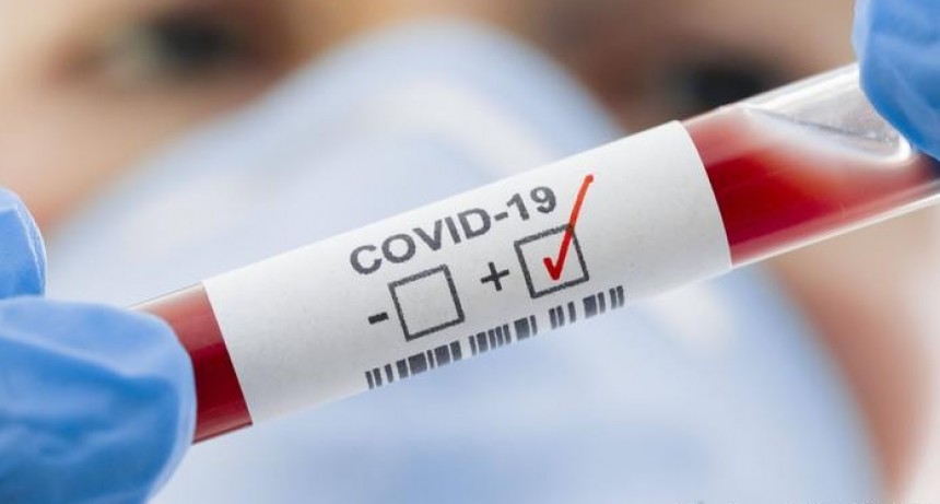 COVID-19:  614 muertes en las últimas 24 horas