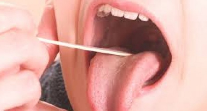 Salud reportó 118 casos confirmados de Streptococcus pyogenes 
