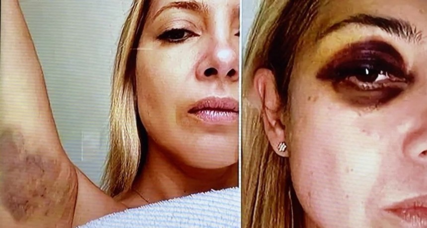 Se conocieron fotos de Fabiola Yáñez golpeada y chats reveladores