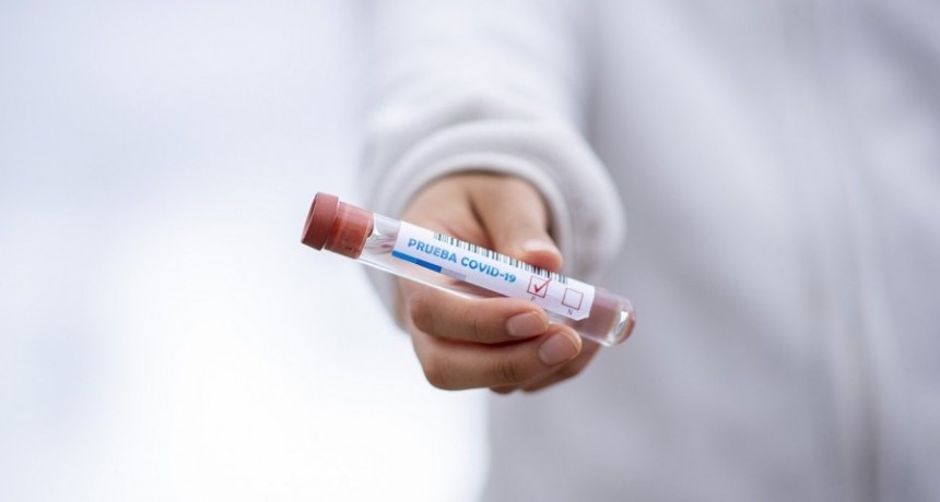  13.477 personas  fueron diagnosticadas con coronavirus en el país